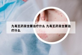 九毒王药膏主要治疗什么 九毒王药膏主要治疗什么