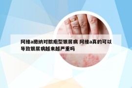 阿维a缴纳对脓疱型银屑病 阿维a真的可以导致银屑病越来越严重吗