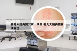 婴儿大腿内侧只有一块白 婴儿大腿内侧有一块白斑