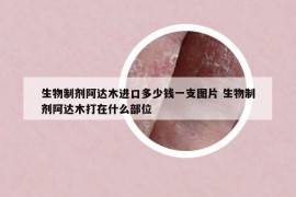 生物制剂阿达木进口多少钱一支图片 生物制剂阿达木打在什么部位