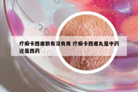 疗癣卡西甫散有没有用 疗癣卡西甫丸是中药还是西药