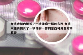 女孩大腿内侧长了一块像癣一样的东西 女孩大腿内侧长了一块像癣一样的东西可用金霉素软膏