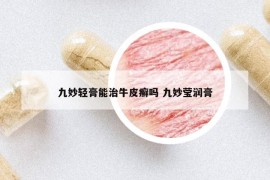 九妙轻膏能治牛皮癣吗 九妙莹润膏