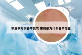 银屑病为何春季复发 银屑病为什么春季加重