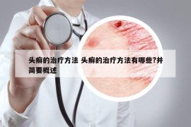 头癣的治疗方法 头癣的治疗方法有哪些?并简要概述