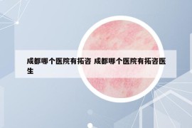 成都哪个医院有拓咨 成都哪个医院有拓咨医生