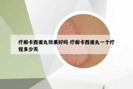 疗癣卡西甫丸效果好吗 疗癣卡西甫丸一个疗程多少天