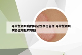 寻常型银屑病的特征性表现包括 寻常型银屑病特征所见有哪些