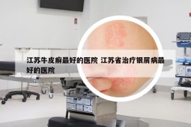 江苏牛皮癣最好的医院 江苏省治疗银屑病最好的医院