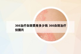 308治疗白斑费用多少钱 308白斑治疗仪图片