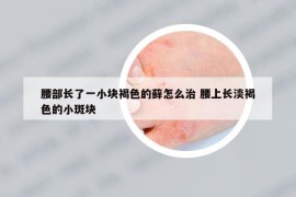 腰部长了一小块褐色的藓怎么治 腰上长淡褐色的小斑块