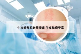 牛皮癣专家老师授课 牛皮肤癣专家