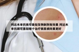 阿达木单抗换可善挺生物制剂有效果 阿达木单抗跟可善挺哪个治疗银屑病效果更好