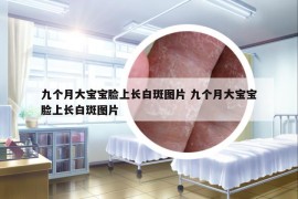 九个月大宝宝脸上长白斑图片 九个月大宝宝脸上长白斑图片