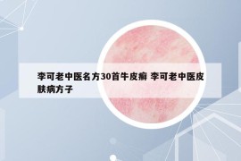 李可老中医名方30首牛皮癣 李可老中医皮肤病方子