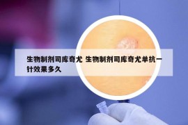 生物制剂司库奇尤 生物制剂司库奇尤单抗一针效果多久