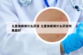 儿童体癣用什么药膏 儿童体癣用什么药膏效果最好