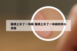 胳膊上长了一块癣 胳膊上长了一块癣四周小疙瘩