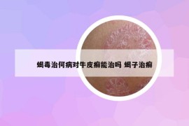 蝎毒治何病对牛皮癣能治吗 蝎子治癣