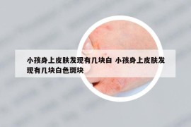 小孩身上皮肤发现有几块白 小孩身上皮肤发现有几块白色斑块