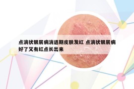 点滴状银屑病消退期皮肤发红 点滴状银屑病好了又有红点长出来