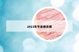 2023年牛皮癣去根