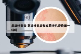 氟康唑乳膏 氟康唑乳膏和克霉唑乳膏作用一样吗