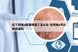 吃了阿维a胶囊喝酒了怎么办 吃阿维a可以喝啤酒吗