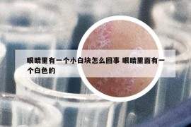 眼睛里有一个小白块怎么回事 眼睛里面有一个白色的