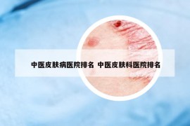 中医皮肤病医院排名 中医皮肤科医院排名