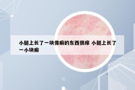 小腿上长了一块像癣的东西很痒 小腿上长了一小块癣