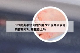 999皮炎平软膏的作用 999皮炎平软膏的作用可以 用在脸上吗