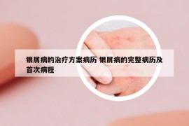 银屑病的治疗方案病历 银屑病的完整病历及首次病程