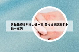 黄柏祛癣搽剂多少钱一瓶 黄柏祛癣搽剂多少钱一瓶药