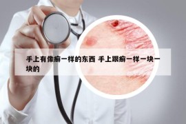 手上有像癣一样的东西 手上跟癣一样一块一块的