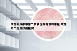 成都哪成都市第二皮肤医院有没有中医 成都第二医皮肤病医院