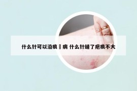 什么针可以沿痕痟病 什么针缝了疤痕不大