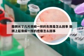 胳膊长了几片跟癣一样的东西是怎么回事 胳膊上起像癣一样的疙瘩怎么回事