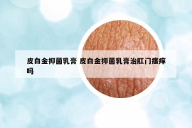 皮白金抑菌乳膏 皮白金抑菌乳膏治肛门瘙痒吗