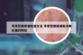 寻常型银屑病检查方法 寻常型银屑病有诊断价值的特征