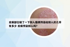 皮癣部位碰了一下别人胳膊传染给别人的几率有多少 皮癣传染别人吗?