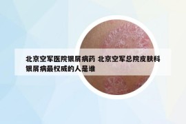 北京空军医院银屑病药 北京空军总院皮肤科银屑病最权威的人是谁