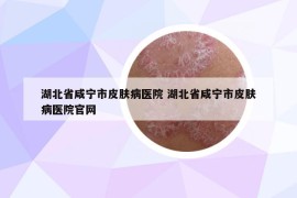 湖北省咸宁市皮肤病医院 湖北省咸宁市皮肤病医院官网