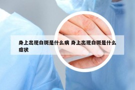 身上出现白斑是什么病 身上出现白斑是什么症状