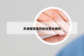 天津哪家医院能检查白癜风