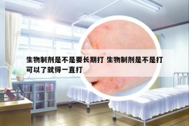 生物制剂是不是要长期打 生物制剂是不是打可以了就得一直打