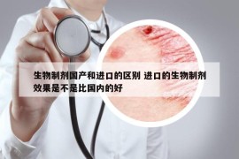 生物制剂国产和进口的区别 进口的生物制剂效果是不是比国内的好