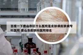 百度一下唐山市区什么医院是皮肤病皮肤病专科医院 唐山市皮肤科医院排名