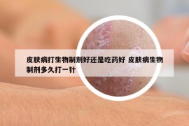 皮肤病打生物制剂好还是吃药好 皮肤病生物制剂多久打一针