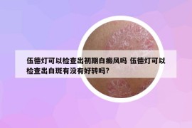 伍德灯可以检查出初期白癜风吗 伍德灯可以检查出白斑有没有好转吗?